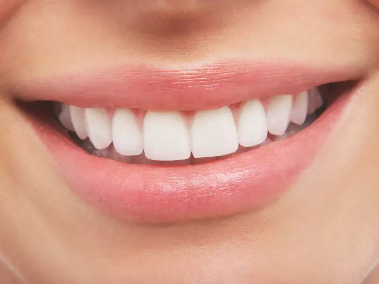 Uzupełnienia na implantach