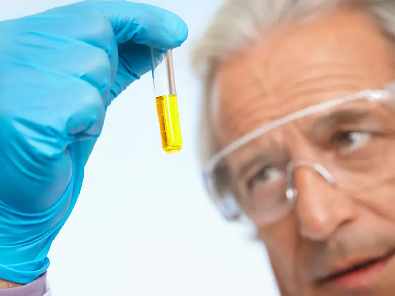 Guzy neuroendokrynne a dobowa zbiórka moczu