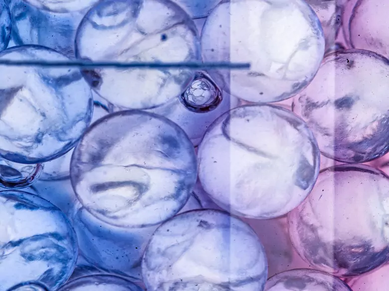 Zatrucie żrącym kwasem - przyczyny, objawy, diagnoza, leczenie