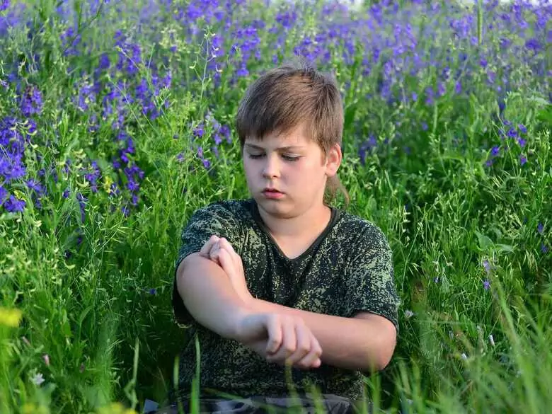 Alergia kontaktowa u dzieci: badania dotyczące czynników, które mogą być jej przyczyną