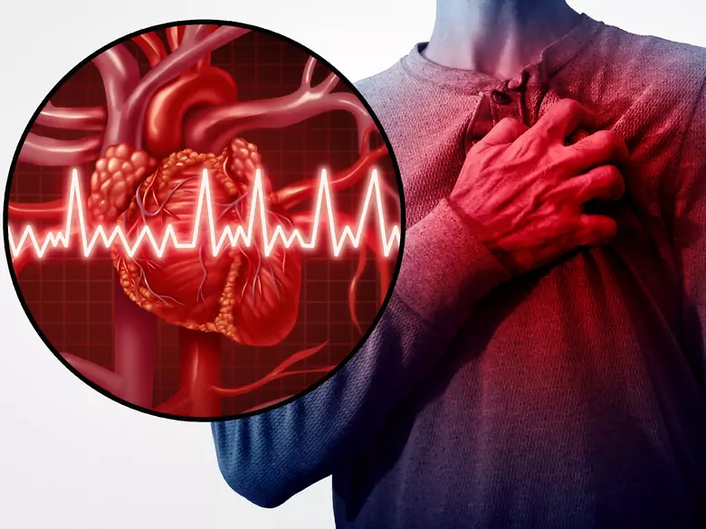 Czym jest „lżejsza” niewydolność serca?