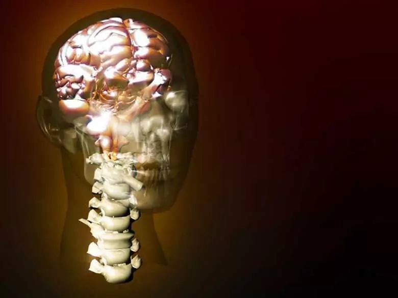 Stwardnienie rozsiane - definicja, postacie, objawy