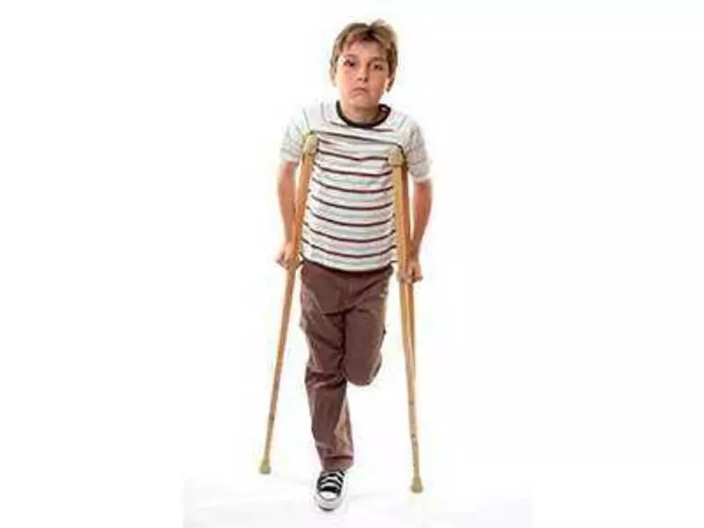 Dystrofia mięśniowa Duchenne’a - przyczyny, objawy, diagnoza, leczenie