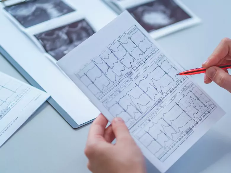 TeleHolter, czyli Mobile Cardiac Telemetry po polsku