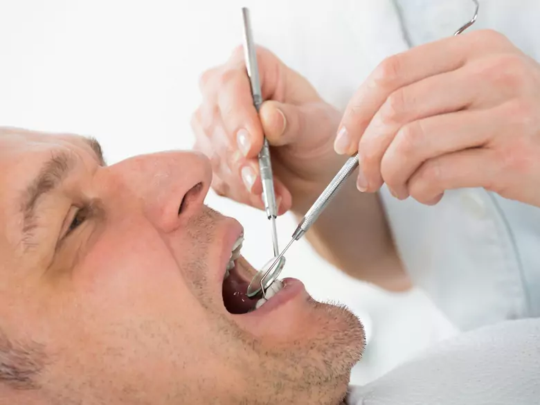 Bierzesz leki? Sprawdź, które mogą mieć skutki uboczne dla zębów