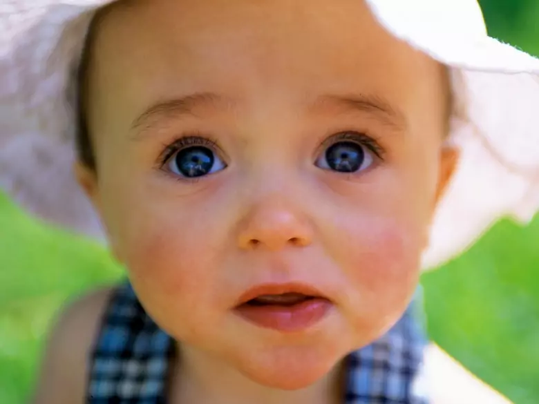 Toksoplazmoza wrodzona - przyczyny, objawy, diagnoza, leczenie