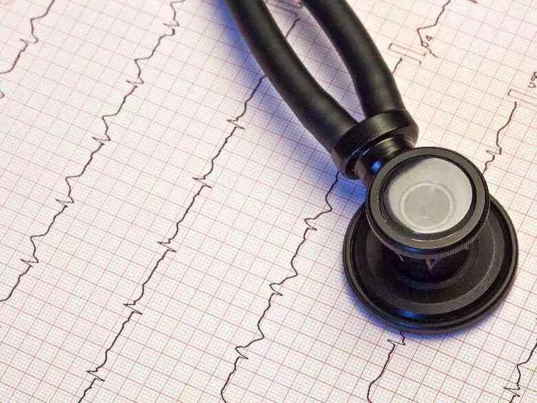 Niewydolność serca - przyczyny, objawy, diagnoza, leczenie, przyczyna duszności