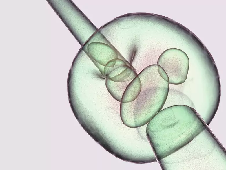 In vitro krok po kroku