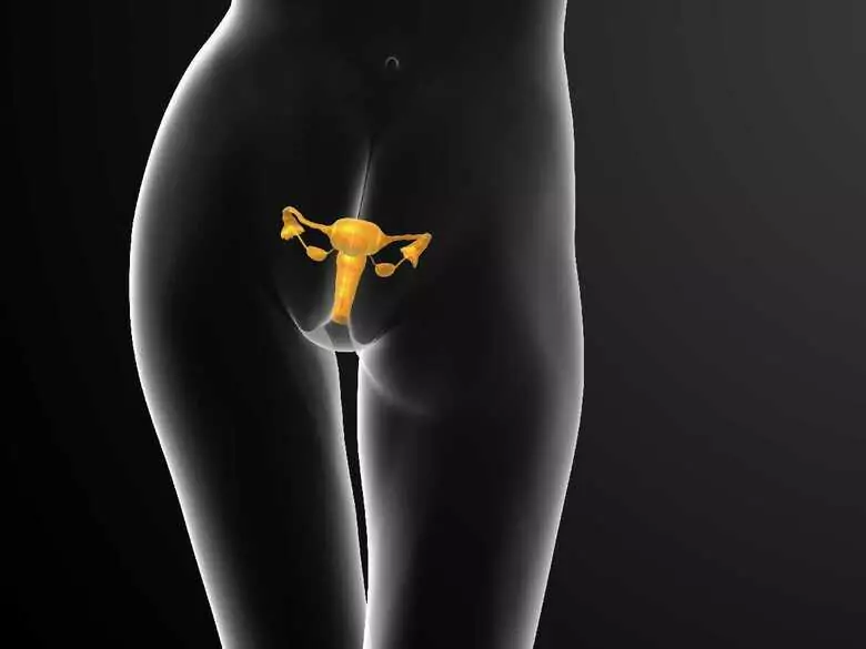 Pęknięcie torbieli jajnika - przyczyny, objawy, diagnoza, leczenie