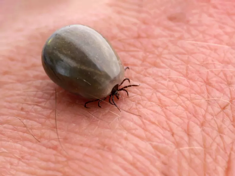 Objawy boreliozy układu nerwowego (neuroboreliozy)