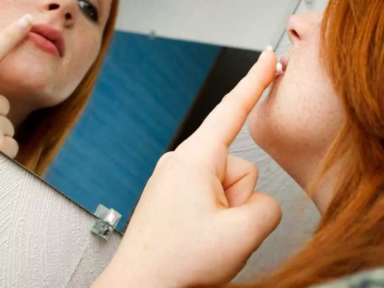 10 pytań o opryszczkę