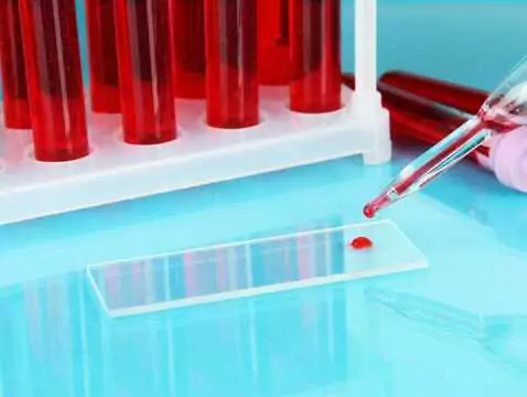 Morfologia – jak odczytać wynik?