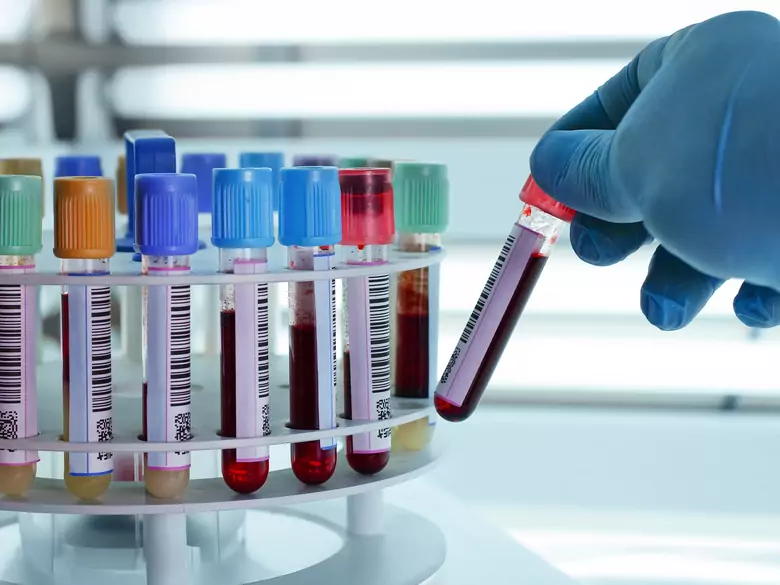 Czym jest czerwienica?