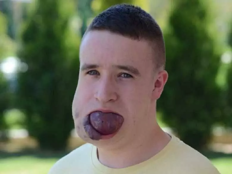 Pomoc dla Krzysia Węgrzyna - apel o wsparcie finansowe na skomplikowane leczenie chłopaka