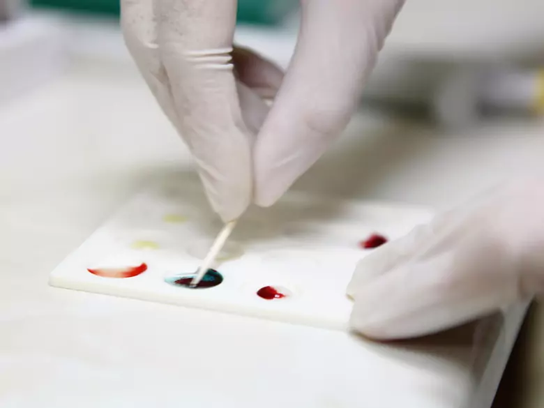 Mleczne produkty fermentowane, a poziom cholesterolu