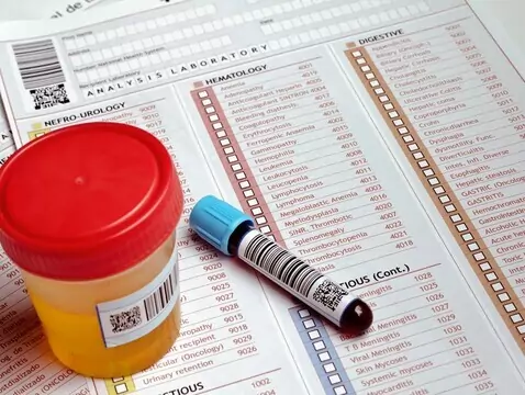 Endokrynologia okresu menopauzy