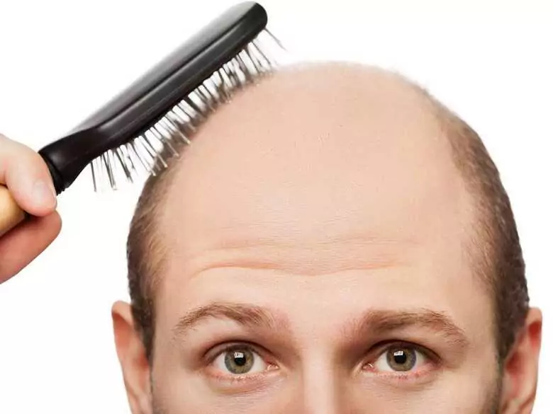 Sterydy? Zamiast rzeźby, niepłodność i łysina