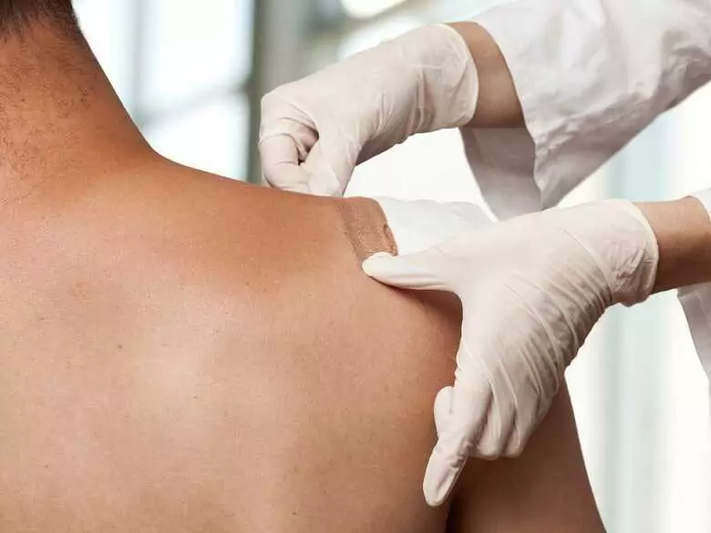 Cena zaniedbania – ile naprawdę kosztuje brak skutecznej terapii ran?