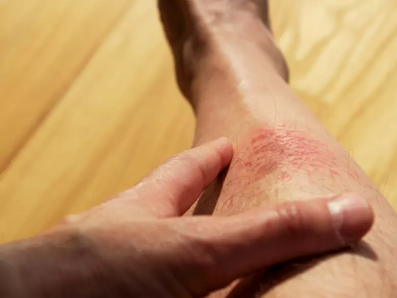 Czy glony mogą tworzyć opatrunki?