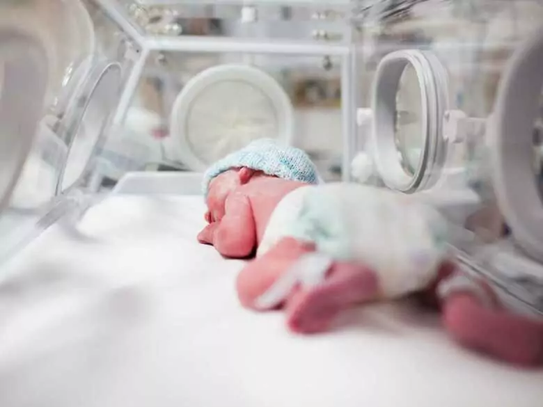 Żółtaczka u noworodka - czym jest i kiedy powinna niepokoić?