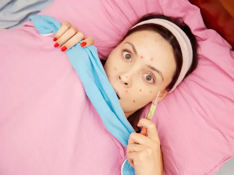 Objawy i konsekwencję ospy wietrznej w wieku dorosłym