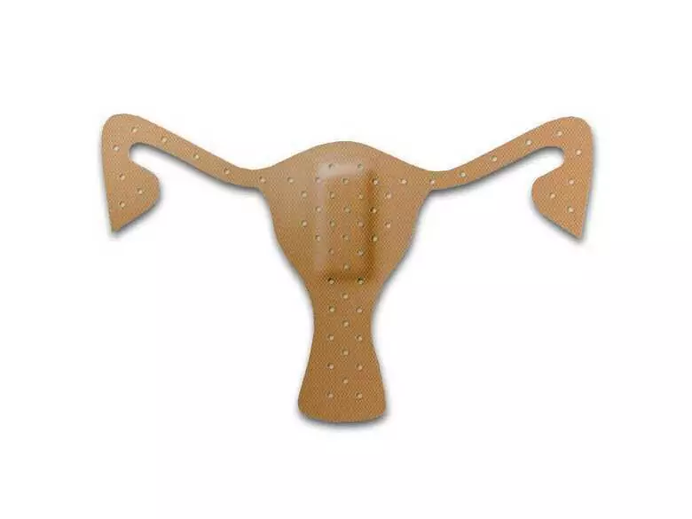 Mięśniaki macicy – co trzeba o nich wiedzieć?