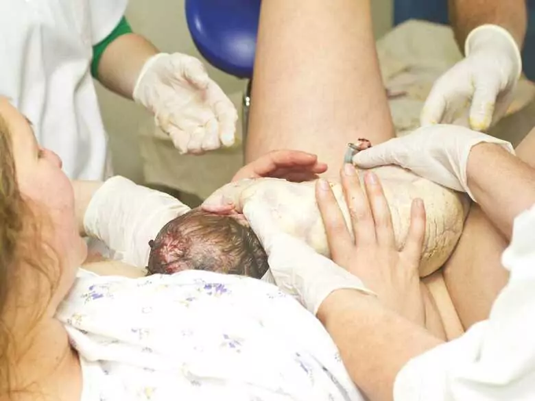 Krew podczas porodu – ile tracimy i kiedy to może być niebezpieczne