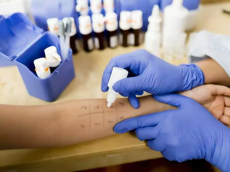 Odczulanie – kiedy warto je stosować?