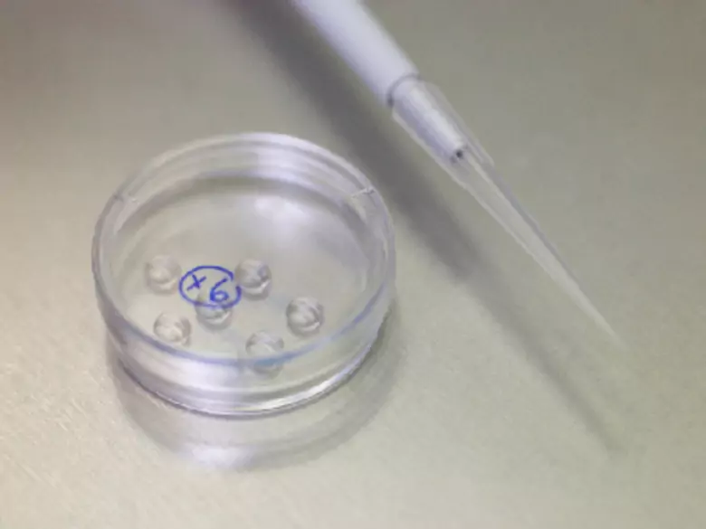 Haemophilus influenzae w wymazie z gardła lub z nosa - przyczyny, objawy, diagnoza, leczenie