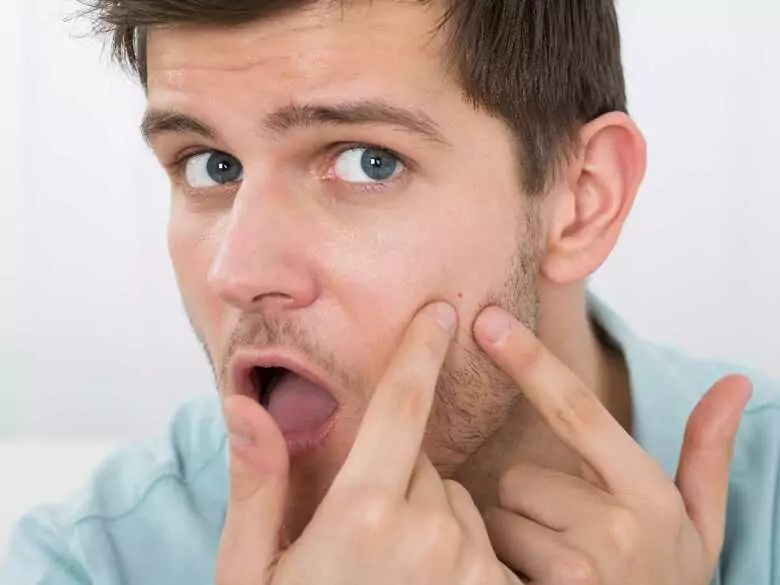 Trzy choroby skóry, które mogą być objawem problemów psychicznych