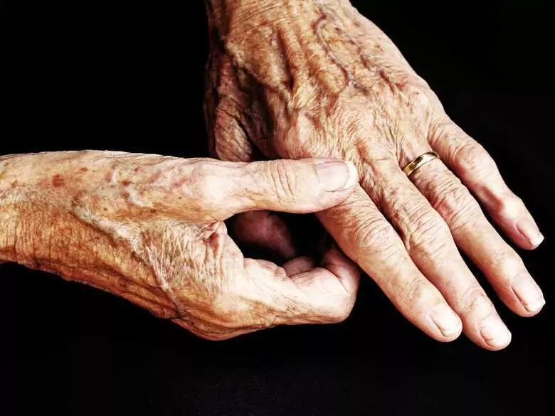 Stymulacja nerwu błędnego a leczenie RZS