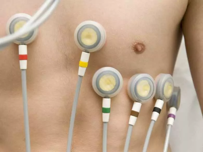 Długoterminowe ciągłe monitorowanie EKG