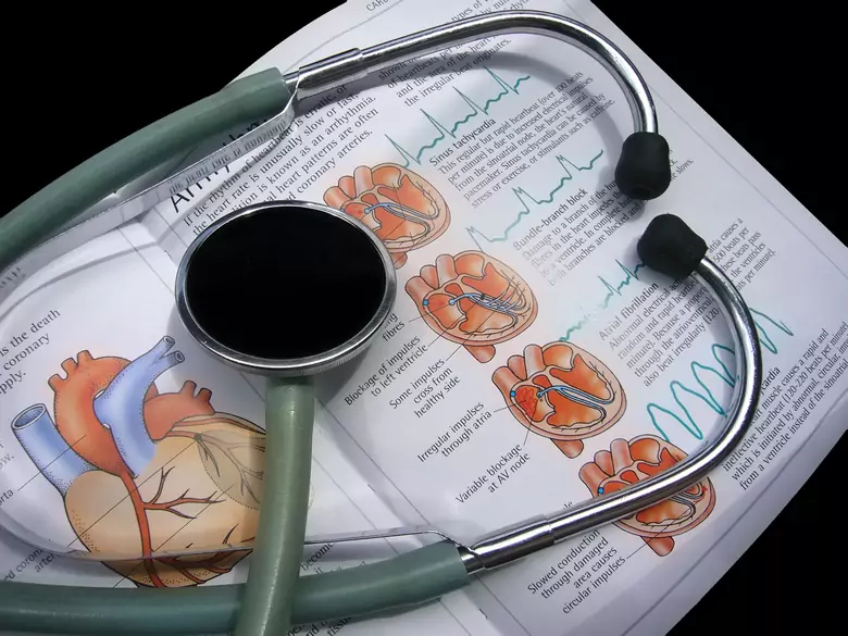 Nadmiar homocysteiny – jeszcze gorszy niż wysoki cholesterolu?