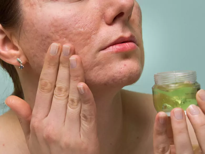 Sposoby na usuwanie blizn