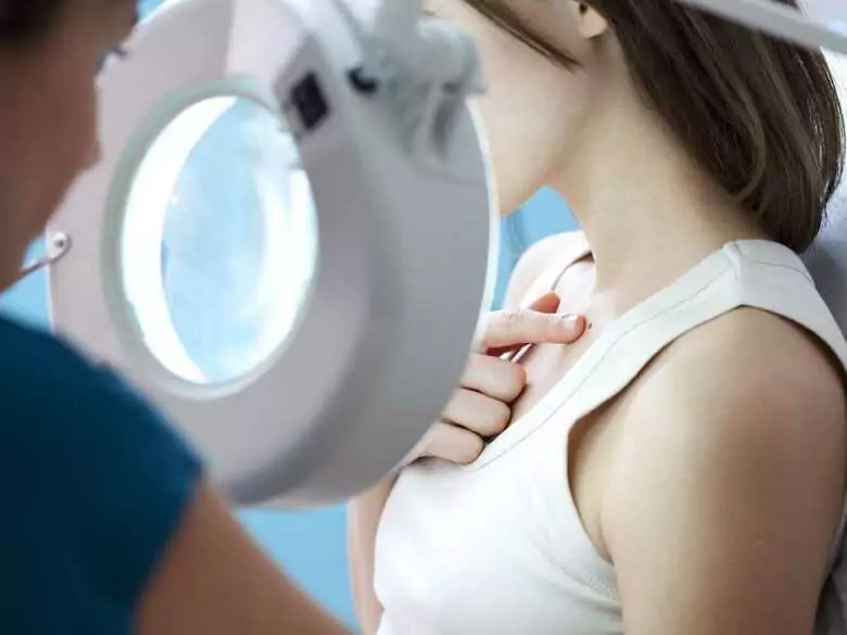 Zmiany skórne, które mogą wzbudzić niepokój