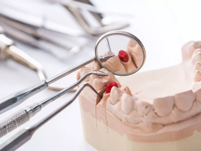 Bezzębie: problem, na który cierpi ponad 9 milionów Polaków