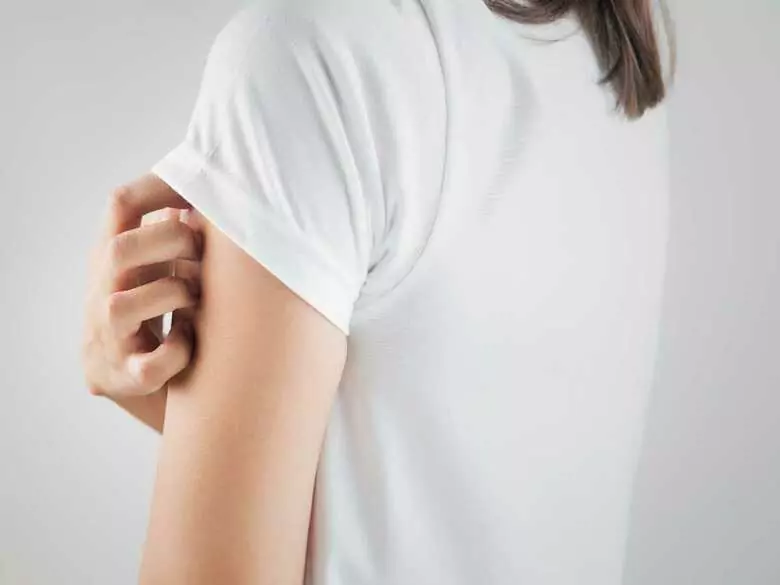 Alergia po zastosowaniu kosmetyków – kiedy niezbędna jest wizyta u lekarza?