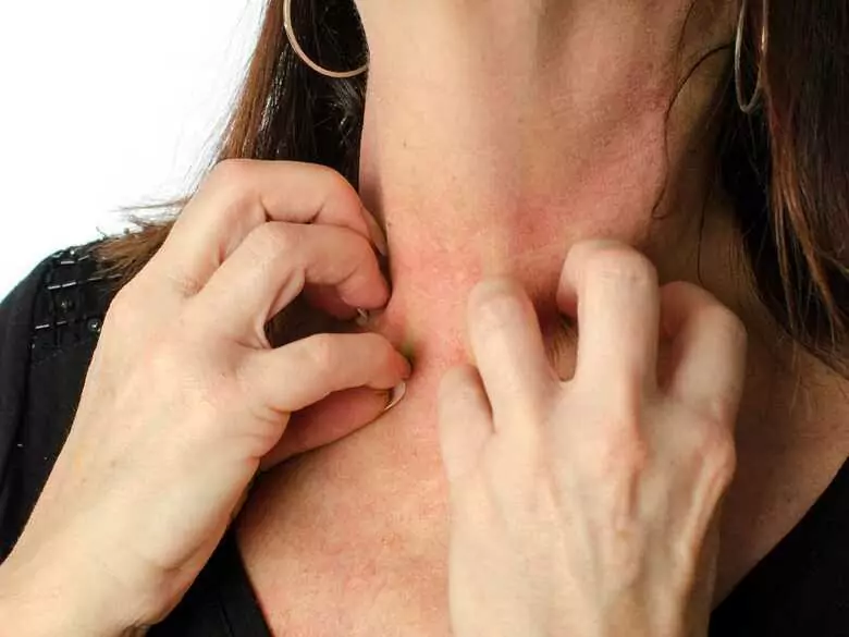 Dlaczego skóra swędzi?