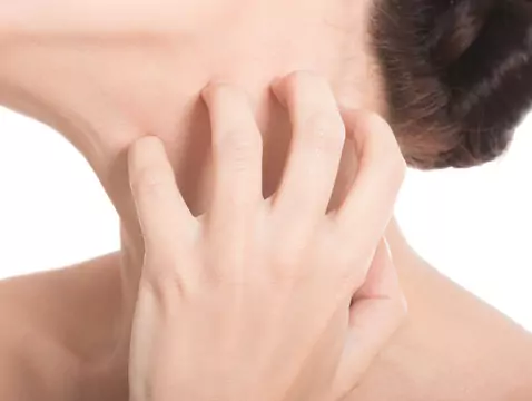 Test autodiagnozy grzybicy