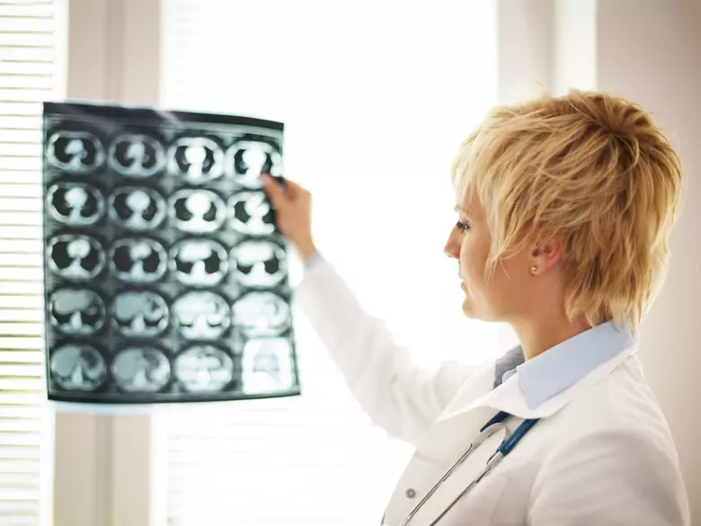 Zaburzenia psychiczne a guzy mózgu