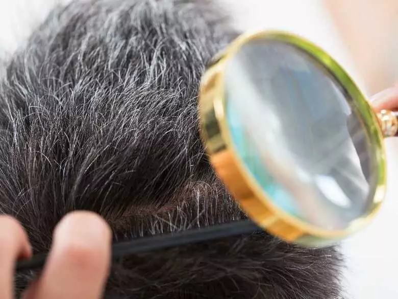 Wszawica u dziecka – jak skutecznie leczyć i zapobiegać?