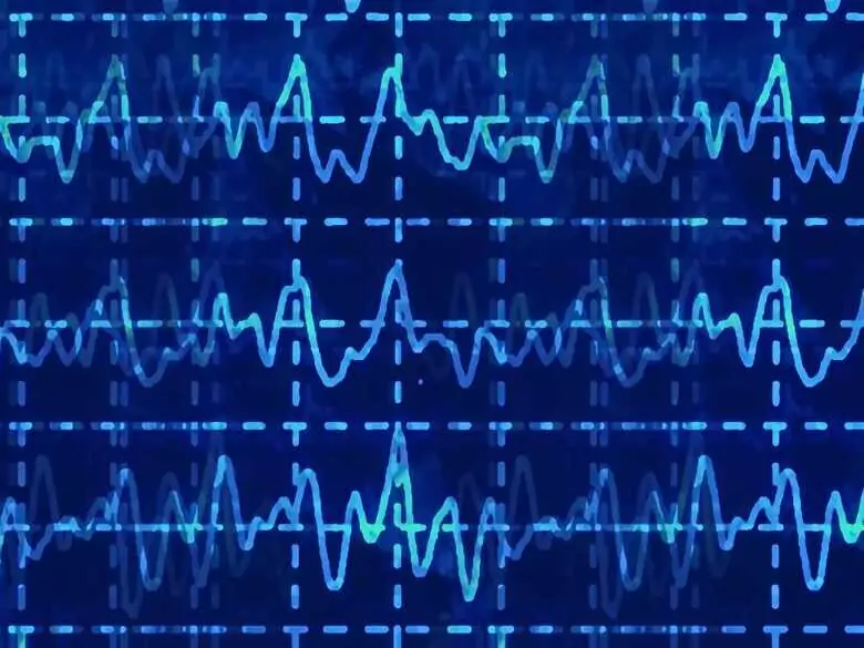 Dzięki Funduszom Europejskim aplikacja, która oferuje więcej niż tradycyjne EKG pomoże osobom z chorobami serca